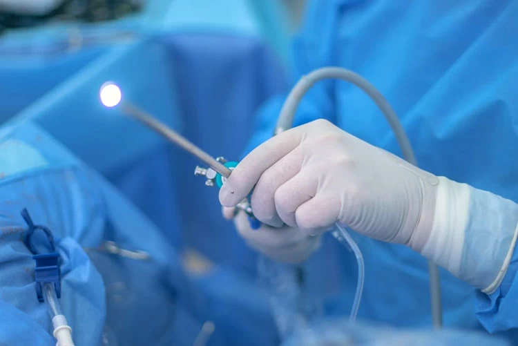 ما هو المنظار الرحمي